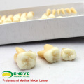 VENDER 12578 Conjunto de Modelo de Estudo Dental Humano de Dentes Permanentes Individuais